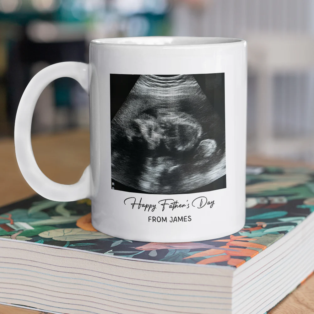 Custom Photo Happy Father's Day Baby Scan Mug - Gift For Father's Day TH10 169933 - Image 3